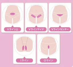 🌟熱破壊式VIO美肌脱毛🌟完全シェービング付で冷却機能・デザイン自由・ホワイトニング効果◎創業40年の実績で安心