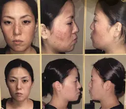 フォトシミケアー通常16500円