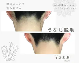 【後ろ姿美人】うなじ脱毛