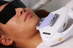 ヒゲ脱毛初回お試し