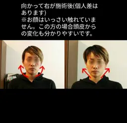 美容整体≪オススメ≫