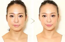 韓国ツヤ肌に【韓国肌管理☆水光艶肌フェイシャル(デコルテ+ヘッド付)60分】¥12000