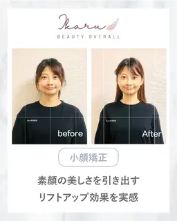 【初回体験】小顔矯正＋ヘッドスパ＋顎関節調整（30分） ¥7000→¥3500