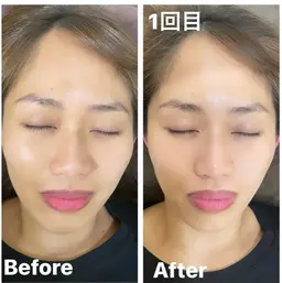 小顔矯正💆♀️💎ブライダルにも♡