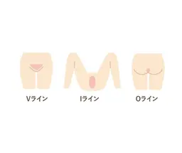 【男性限定】 VIO ダブル脱毛(ブラジリアンワックス+光脱毛の組み合わせ◎)