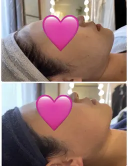 小顔フェイシャル