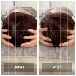 今話題の脳洗浄🌈頭の浮腫を取り除きます！下記料金は通常料金です。モニター価格にて予約の受付開始しております✨