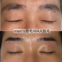メンズ眉毛WAX脱毛