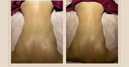 💆痩身マッサージ💆