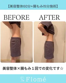 美容整体×腸もみ