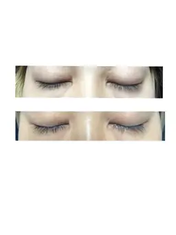 まつげ育成🤩ラッシュアディクト【荻窪/西荻窪】