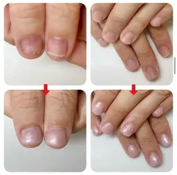 【ミニモ限定】深爪矯正長さだし💅見た目もかわる✨「長さだし+ワンカラー」