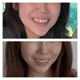 表情筋トレーニング レッスン体験モニター