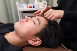 【美容鍼×整体】顔周りの悩みをしっかり改善!