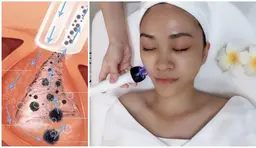 毛穴角栓・黒ずみ洗浄ハイドラフェイシャル+ハイパ-+ハンド60分¥9800→