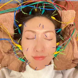 🧸リピーター様🧸✨【美容鍼+電気】首肩背中ヘッドマッサージ付き|しっかりケア