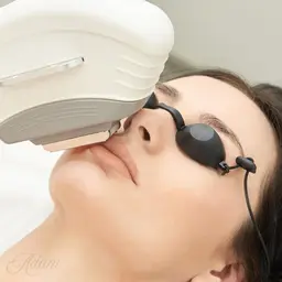 【美容脱毛】全顔脱毛/眉下もできる❣産毛まで即効果実感！シェービング込