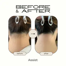 【脇orうなじorデコルテorもみあげ】ワックス脱毛