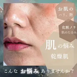 ツルモチ卵肌ケア【乾燥/毛穴黒ずみ/美白/シワシミ/たるみ】