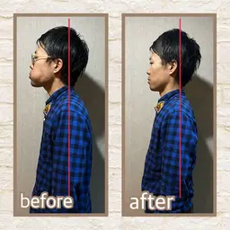 🔹頸椎矯正ストレッチ🔹肩こりからくる頭痛、目眩にお悩みの方必見!ストレートネックも改善✨