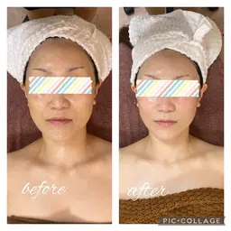 衝撃小顔コース!小顔矯正+美肌フェイシャル+首デコルテマッサージ!ゴットハンドでうっとりしながらたるみケア!