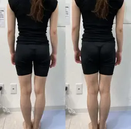 ✨学割U24✨【小顔矯正＋骨盤矯正＋頭蓋骨矯正】小顔も美脚も美姿勢も叶う‼️全身脱毛ネイルヨガ後にも🍀リフトアップケア