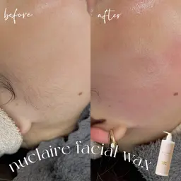 ⬜️フェイシャルワックスヌクレール！産毛除去/毛穴/乾燥肌改善⬜️