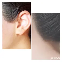 うなじ&襟足(衣紋抜き部分まで)&もみ上げwax+保湿パック付き✨(初回)