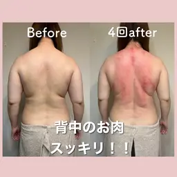 上半身のコリ撲滅！！韓国式カッサ&スライドカッピング&オイルリンパトリートメント