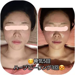 ミニモ限定!骨気|小顔・リフトアップ効果💎首肩デコルテマッサージ付きで癒しも◎¥7000→6600