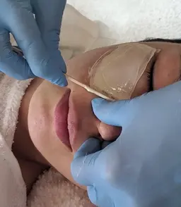 フェイシャルワックス脱毛&イオン導入(美白パック付)　お顔の明るさアップ！つるすべ美肌へ✨