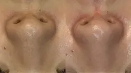 毛穴洗浄、細胞活性化などトータル美肌ケア。メンテナンスにも最適