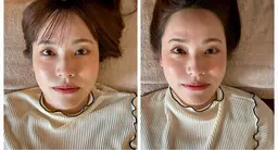 神速スッキリ!脳疲労リセットヘッド × 頭皮エア美容鍼【ミニモ限定】