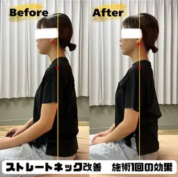 ミニモ特集 期間限定 ストレートネック改善 40分 🌸お写真掲載OKの方限定🌸