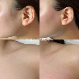 新生活に🎒【VIO+(もみあげorデコルテ)ワックス脱毛】