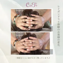 メンズ痛くない頭蓋骨小顔矯正