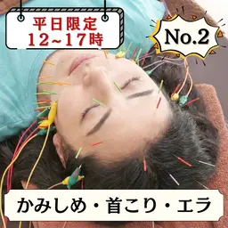 【平日限定☆12​〜​17時】美容鍼＋首マッサージ＋ヘッドスパ　¥12,000→￥4,980