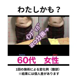 【女性限定／限定1名】無料相談30分｜3ヶ月ダイエット特別モニター