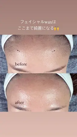 ミニモ価格フェイシャルwax