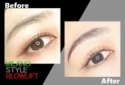 ミラノスタイルブロウリフト