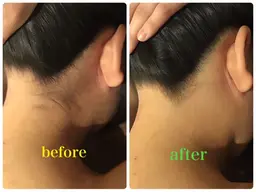 最新ハイブリッド脇脱毛✨