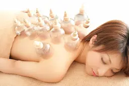 カッピング（吸い玉）＆むくみスッキリ全身整体　60分