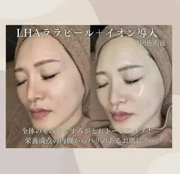 13日〜19日限定価格!!!🌼韓国で大人気🌙【ララピール】⚠️注意事項確認必須