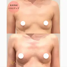 【本気の育乳‼️】全身マッサージで一回でふわふわ感動バスト✨️下垂/ボリューム/産後/左右差