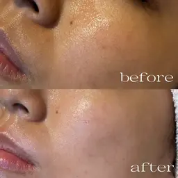 🌹フェイシャルWaxxxx🌹