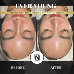 【✨1回で肌印象UP】EVER YOUNG｜うるおい・ハリ・毛穴ケアをまとめてサポート〈メンズOK〉