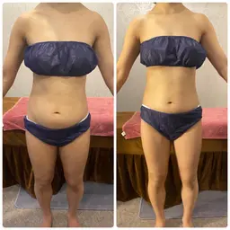 単発2回完了痩身！通常のお試しだと質量が少ないですが最初から仕上げるためしっかり行うボディ