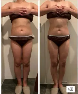 オーダーメイド痩身💗どんな部位でも💗