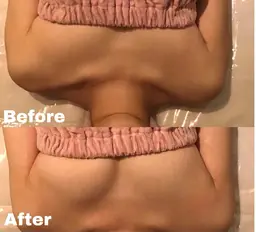 ✨ハイブリット最新の機器✨全身バストケア60分🍀大きさ、左右差、下垂などのお悩みに❣️