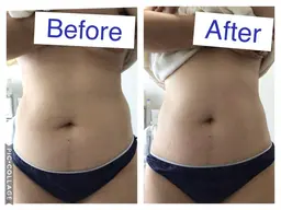 【ホットストーン痩身🔥腸温活🔥】腸揉み＋部分リンパマッサージ 60分